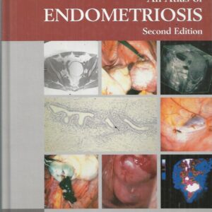 Atlas of Endometriosis (2nd Edition)